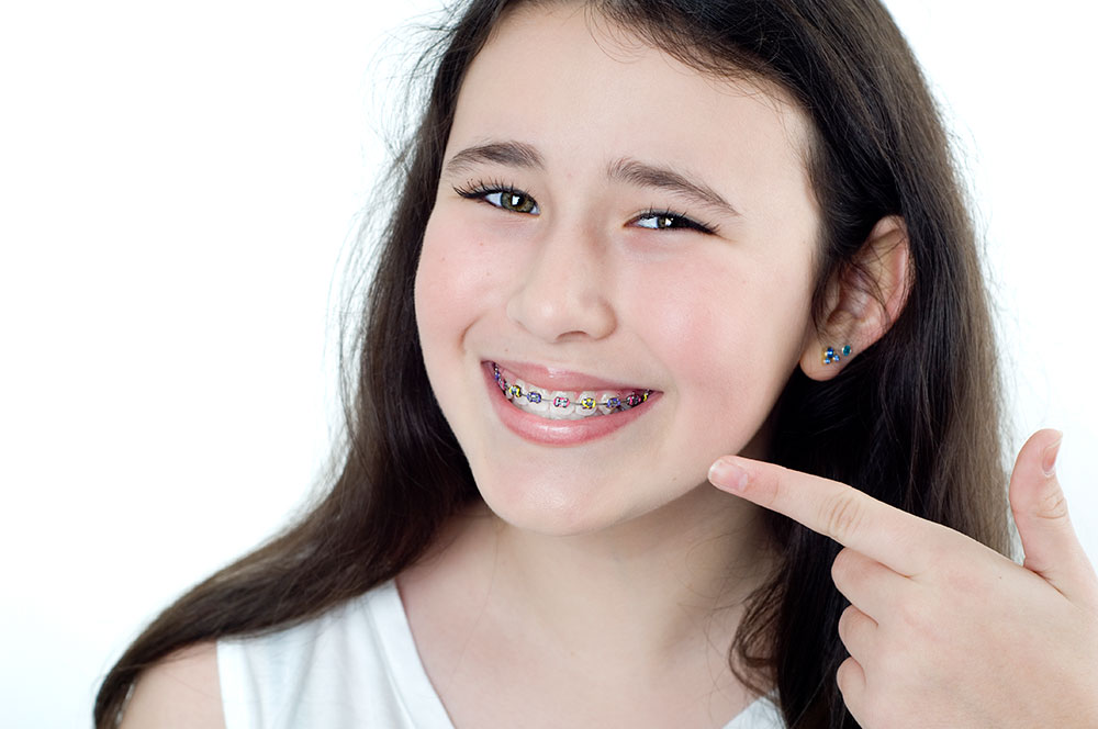 Young Girl Fixed Metal Braces