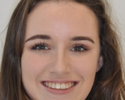 Beautiful Smile O'Keeffe Orthodontics