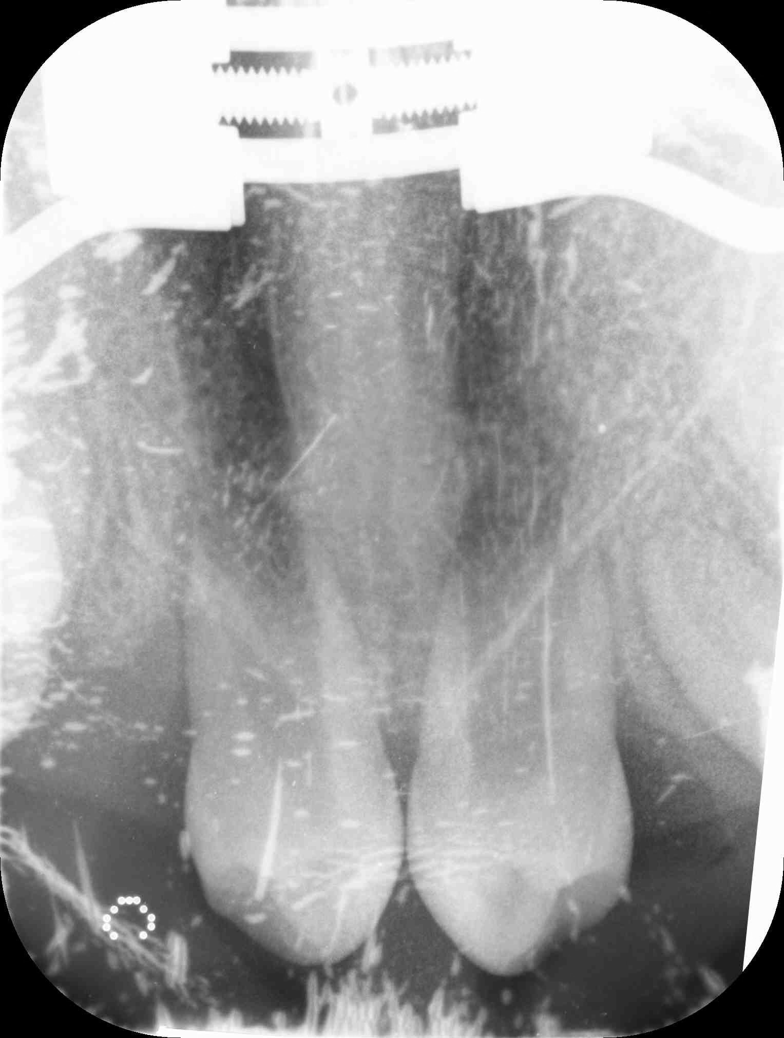 Lateral Ceph X-Ray
